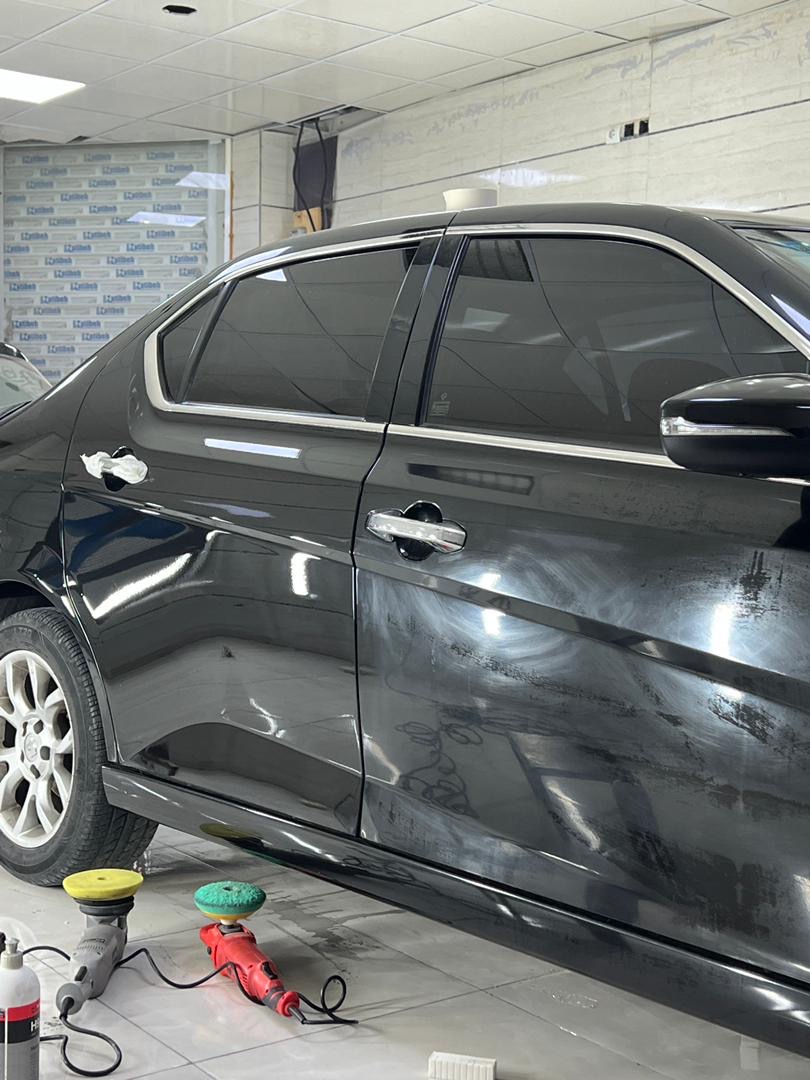 فرق بین قبل و بعد